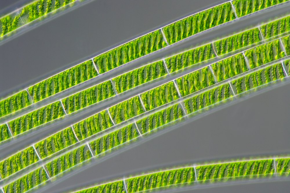 Spirogyra strands under magnification